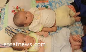 عکس تزئینی است