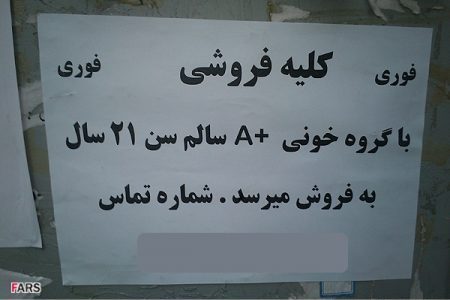 کلیه فروشی