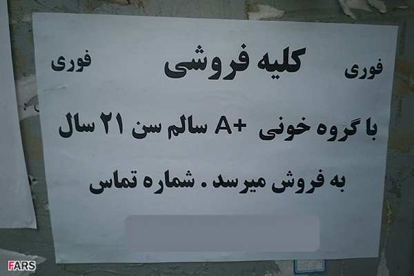 فروش اعضای بدن