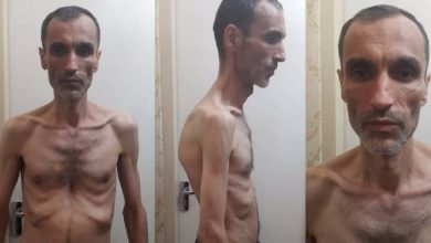 انتشار عکس دلخراش حمید بقایی
