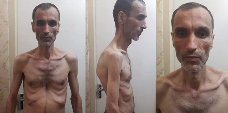 انتشار عکس دلخراش حمید بقایی