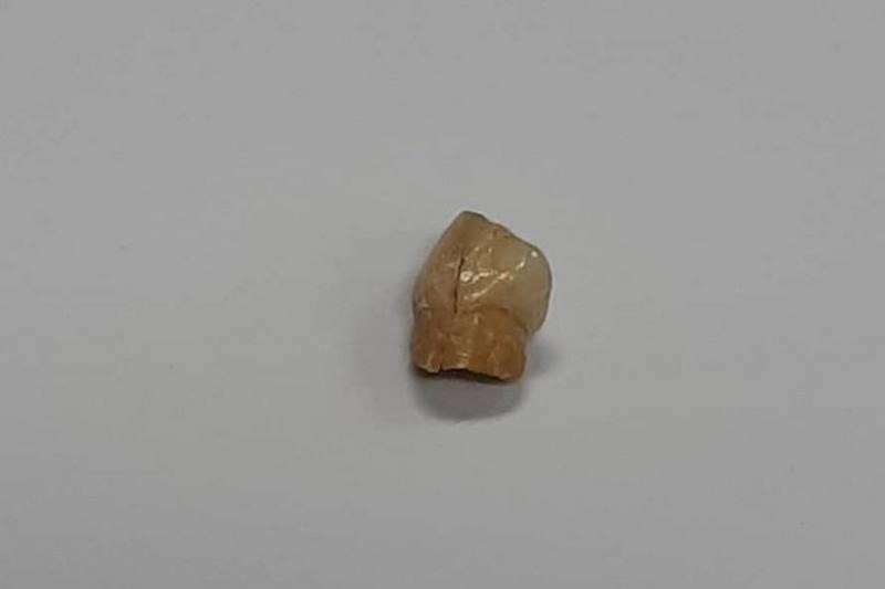 جستجوی جزییات دندان نئاندرتال کرمانشاه