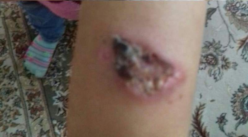 انتقاد به سالک دربارهی شیوع سالک