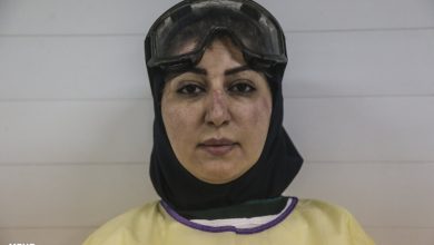 احساساتی که کبودی چهره یک خانم دکتر برانگیخت