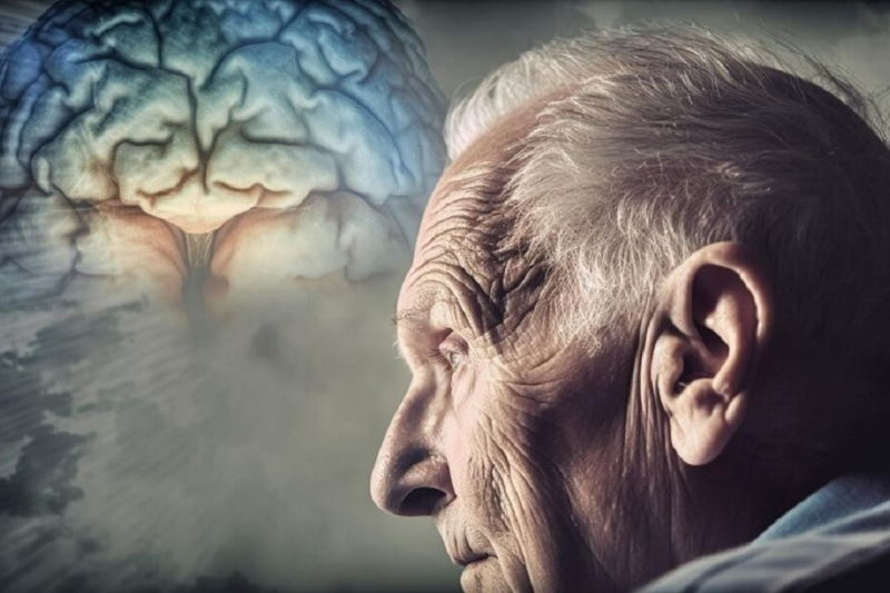 مدیرکل بهزیستی کرمان: هر ۷ دقیقه یک ایرانی به آلزایمر مبتلا میشود